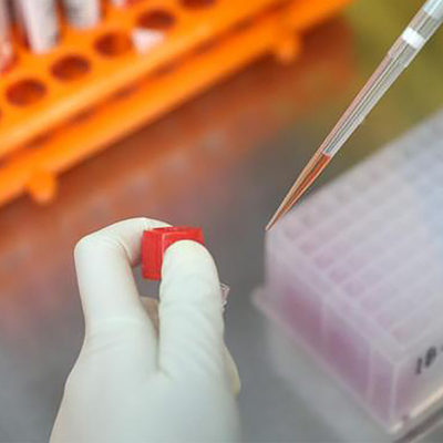 Monkeypox Virüsü IgM IgG Test Kiti Kolloidal Altın CE Kayıtlı
